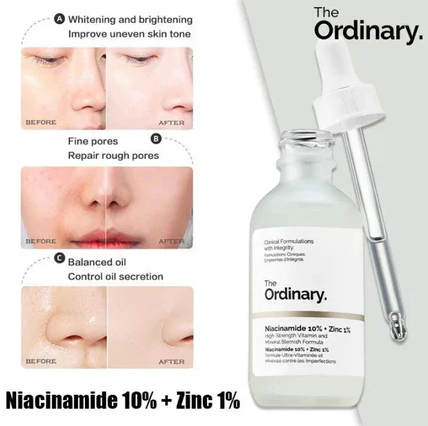 The Ordinary Niacinamide 10% + Zinc 1% Serum – 30ml [Buy 1 Get 1 Free]